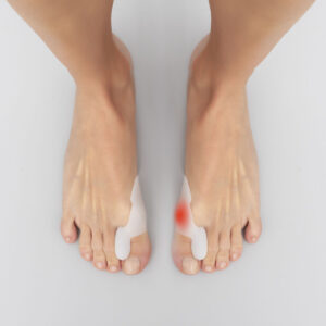 Corretores de Silicone para Joanetes (2 unidades)